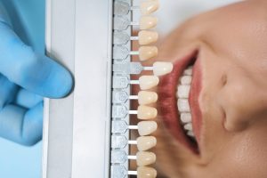 Close up of cheerful woman seeing dentist for improving oral health and beautiful smile with dental veneers